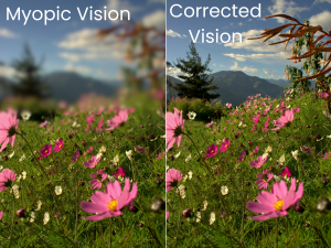 Myopia and corrected vision